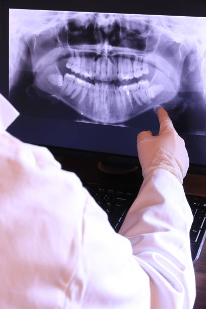 Best Emergency Treatment for Oral Infections in Eulyptus Hills, CA