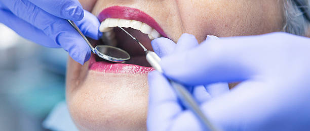 Best Emergency Root Canal Therapy in Eulyptus Hills, CA